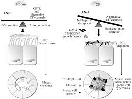 models of chronic lung infection