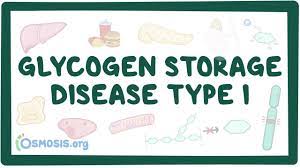 glycogen storage disease type i an
