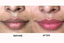 how to lighten dark lips 10 most