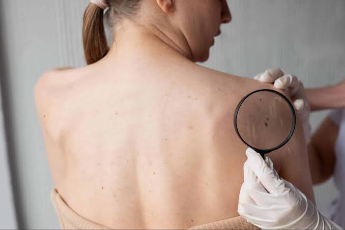 20 Most Ignored Cancer Symptoms - North Houston Cancer Clinics