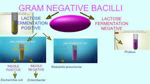 bacterial tests gram negative bacilli