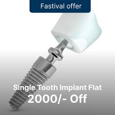 cost of dental implants in india