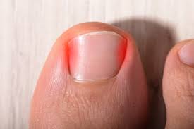 pain around the toenails