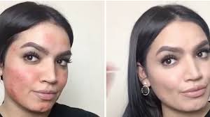 makeup tutorial for covering up acne