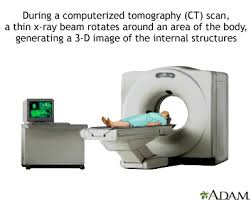 heart ct scan medlineplus cal