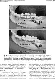 Growth and development orthodontic mcq. The Distal Movement Of Mandibular Molars Is Pdf Free Download
