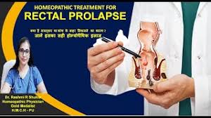rectal prolapse treatment without