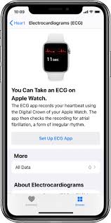 Taking An Ecg With The Ecg App On Apple Watch Series 4 Or