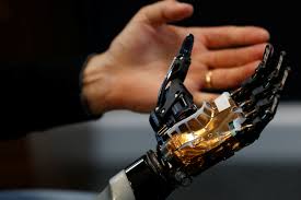 bionic hand can be updated with new
