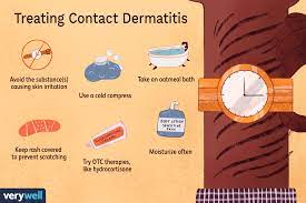 contact dermais treatment and
