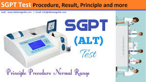 Sgpt is a sensitive indicator of the liver damage or injury due to different types of disease. Sgpt Test Procedure Result Principle And More Lab Tests Guide