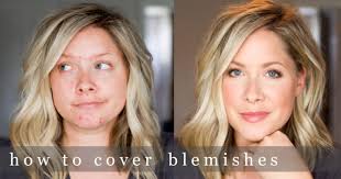 how to conceal those daggone blemishes
