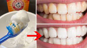 whitening teeth with baking soda