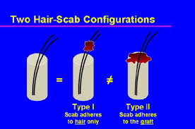 hair scab configurations