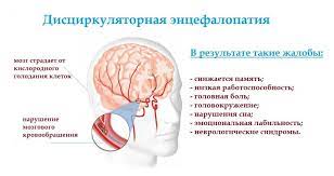 Энцефалопатия — это общее название невоспалительных болезней головного мозга. Lechenie Discirkulyatornoj Encefalopatii V Sankt Peterburge
