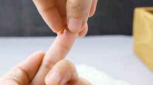 super glue on skin here s how to get
