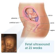 Fetal Ultrasound 5 Months Babycentre Uk