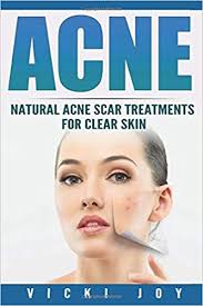 Check spelling or type a new query. Acne Natural Acne Scar Treatments For Clear Skin Clear Skin Clear Skin Diet Acne Scar Treatment Acne Treatment Acne Scars How To Get Rid Of Pimples Dermatology Joy Vicki 9781535356947 Amazon Com Books