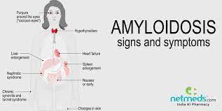 amyloidosis causes symptoms and treatment