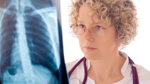 Plicní embolie může být život ohrožující a v některých případech může pacienta zabít do několika minut. Plicni Embolie Ordinace Cz