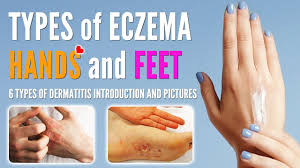 feet dermais types with pictures