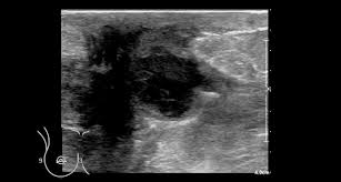 the radiology istant ultrasound of