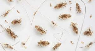 head lice what they look like and what