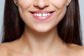 However, dental bonding can chip or wear in time, so. How To Fix Gap Teeth Smart Smile Orthodontics Brisbane