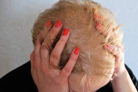 autoimmune diseases that cause hair loss