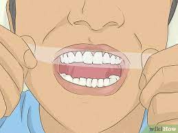 You will also learn cool and easy home remedies for teeth whitening. 4 Ways To Get Whiter Teeth At Home Wikihow
