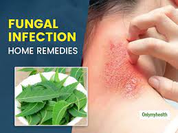 fungal skin infection bothering you