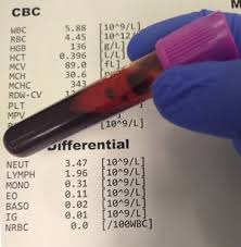 blood tests physiopedia