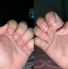 strengthener to grow naturally long nails