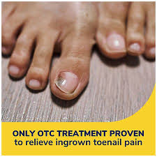 ingrown toenail pain reliever