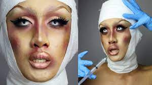 botched plastic surgery halloween