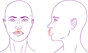 lip lift in feminization surgery