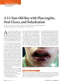 boy with pharyngitis ulcers