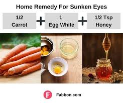 sunken eyes guide pics causes 15