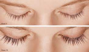 Always apply latisse at nighttime if you plan on using eyelash extension during the day. Your Lash Growth Product Is Prematurely Aging Your Eyes Dr Kenneth Steinsapir M D