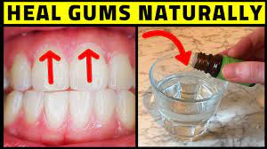 cure periodontal disease at home heal