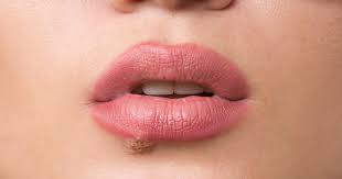 cold sore versus canker sore how to