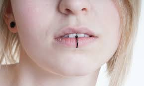 dental concerns with piercings