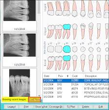 tooth chart overview