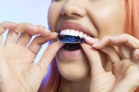 Gap in my teeth question: Adult Orthodontic Treatment Options For Tooth Gaps Bruce Orthodontics Rhinelander Wi