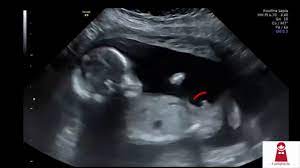 شكل الجنين في الشهر الخامس الولد