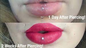 vertical labret piercing swelling