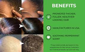 Biotin, also known as vitamin b7, stimulates keratin production in hair and can increase the rate of follicle growth. Amazon Com Biotin Hair Growth Serum Advanced Topical Formula To Help Grow Healthy Strong Hair Suitable For Men And Women Of All Hair Types Hair Loss Support By Pureauty Naturals Beauty