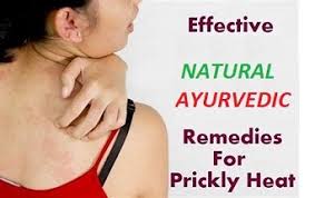 sooth ly heat with ayurvedic remes