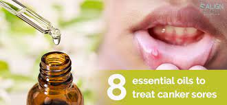 canker sores essential oils