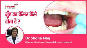 mouth cancer causes and symptoms